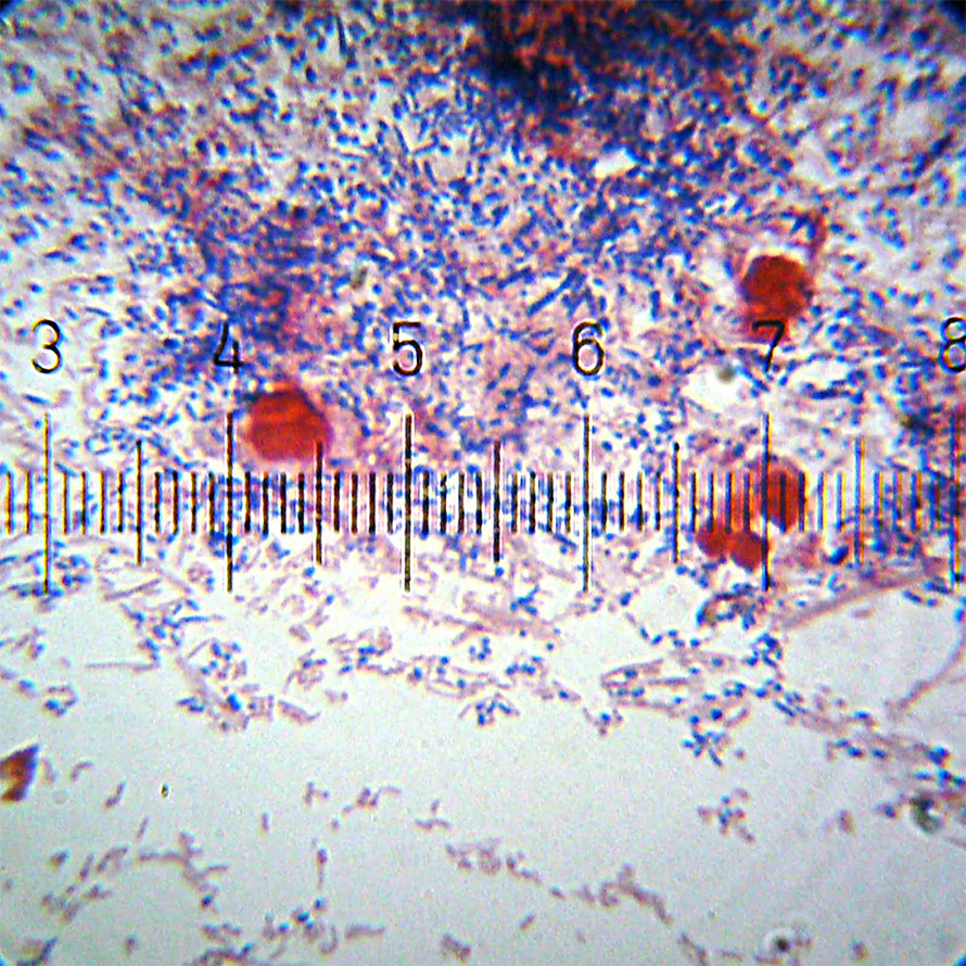 This microscopic view of dental plaque shows Gram-positive and Gram-negative bacteria. Dental plaque is a biofilm that can trap acids that cause tooth decay.