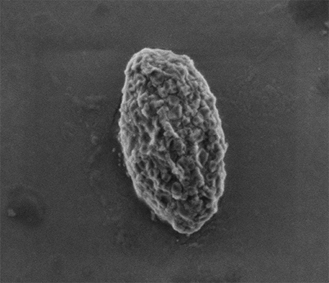Scanning electron micrograph of a Lafora body, an insoluble glygogen aggregate, that can form in the brain, heart, skin and other peripheral tissues of patients with Lafora disease.