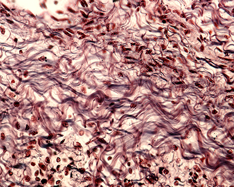 The Haltiwanger lab works on glycosylated protiens that make up the extracellular matrix and connective tissues such as fibrillin.