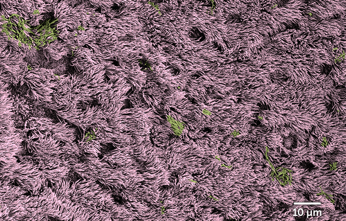 Healthy human cells (labeled pink) from the lining of airways grow in “lawns” laced with some mucus (green) in this colorized electron micrograph.