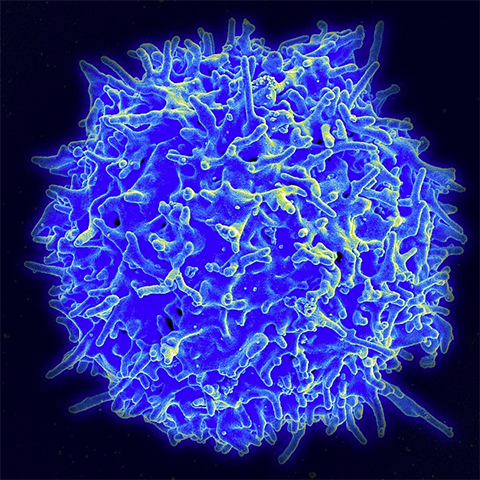 Scanning electron micrograph of a human T lymphocyte (also called a T cell) from the immune system of a healthy donor.