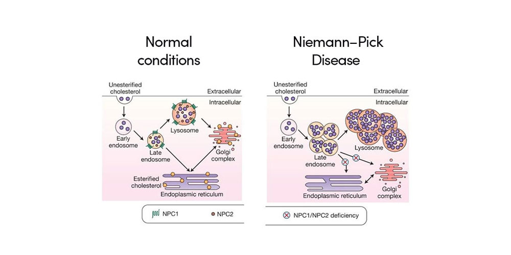 Two-Year-Old Kamryn Living with Niemann-Pick Disease Type C (NPC) - The  Children's Inn at NIH