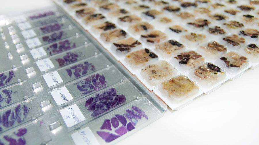 Optimized proteomic analysis of preserved biological tissue samples