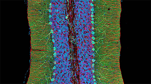 Addgene expands its collection into antibodies