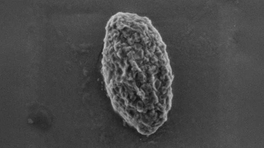 Using 'nature’s mistakes' as a window into Lafora disease
