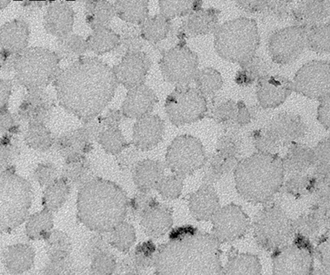 This transmission electron micrograph shows adiposomes, which were used to generate the artificial lipoproteins in this study.