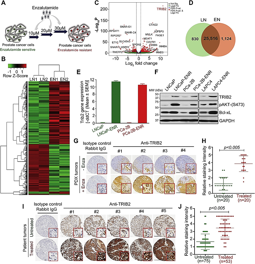 This figure illustrates the over expression of TRIB2 in enzalutamide-resistant prostate cancer cells and tumors.