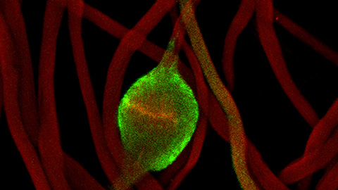 How lipid metabolism shapes sperm development