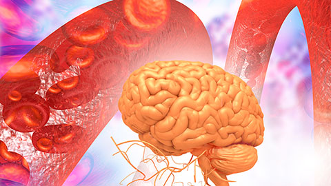 Long-chain polyunsaturated fatty acids linked to postoperative delirium risk